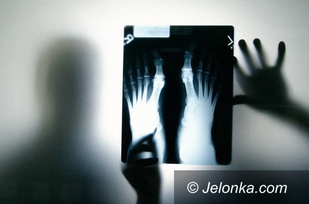 JELENIA GÓRA: Szpital wojewódzki bez rentgena