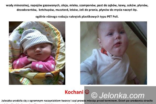 Region: Trwa akcja „Nakręteczki dla Juleczki”. Przyłącz się!
