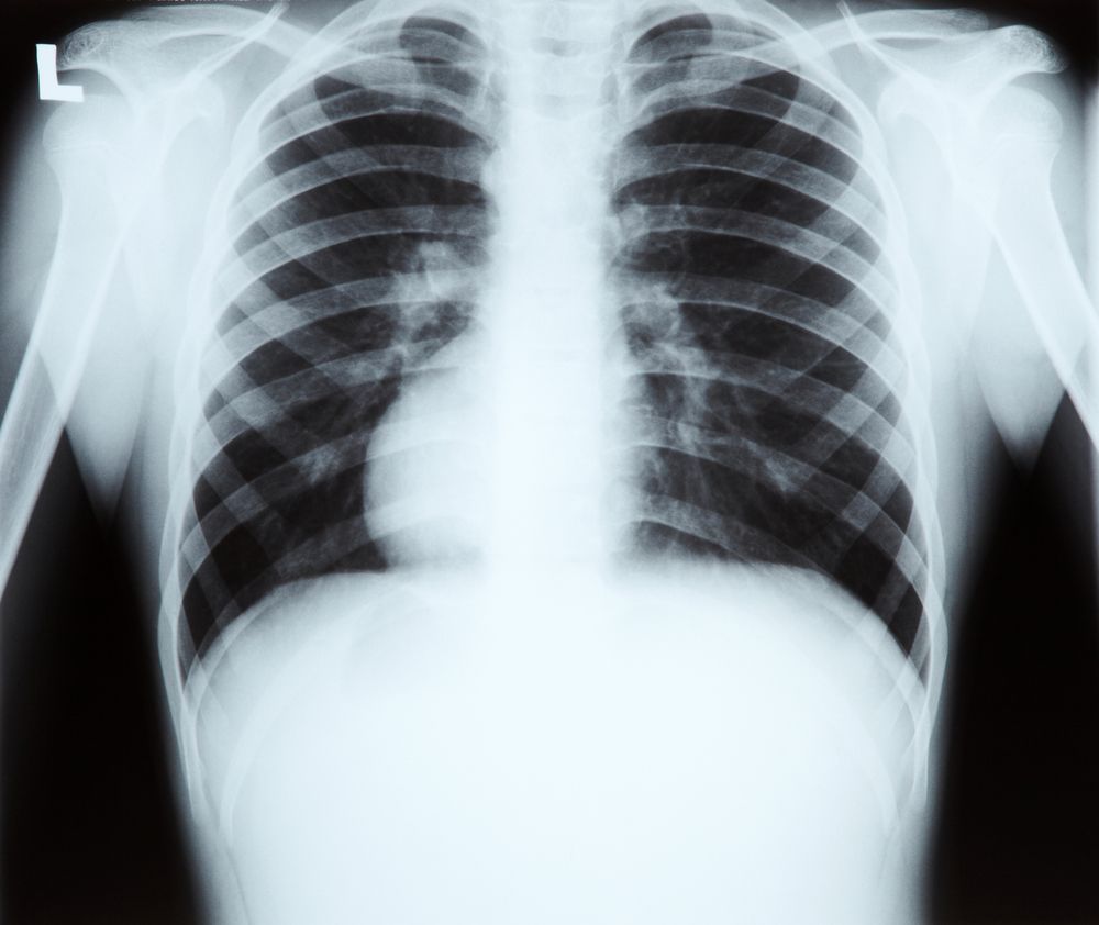 Kraj: Dzień Radiologii
