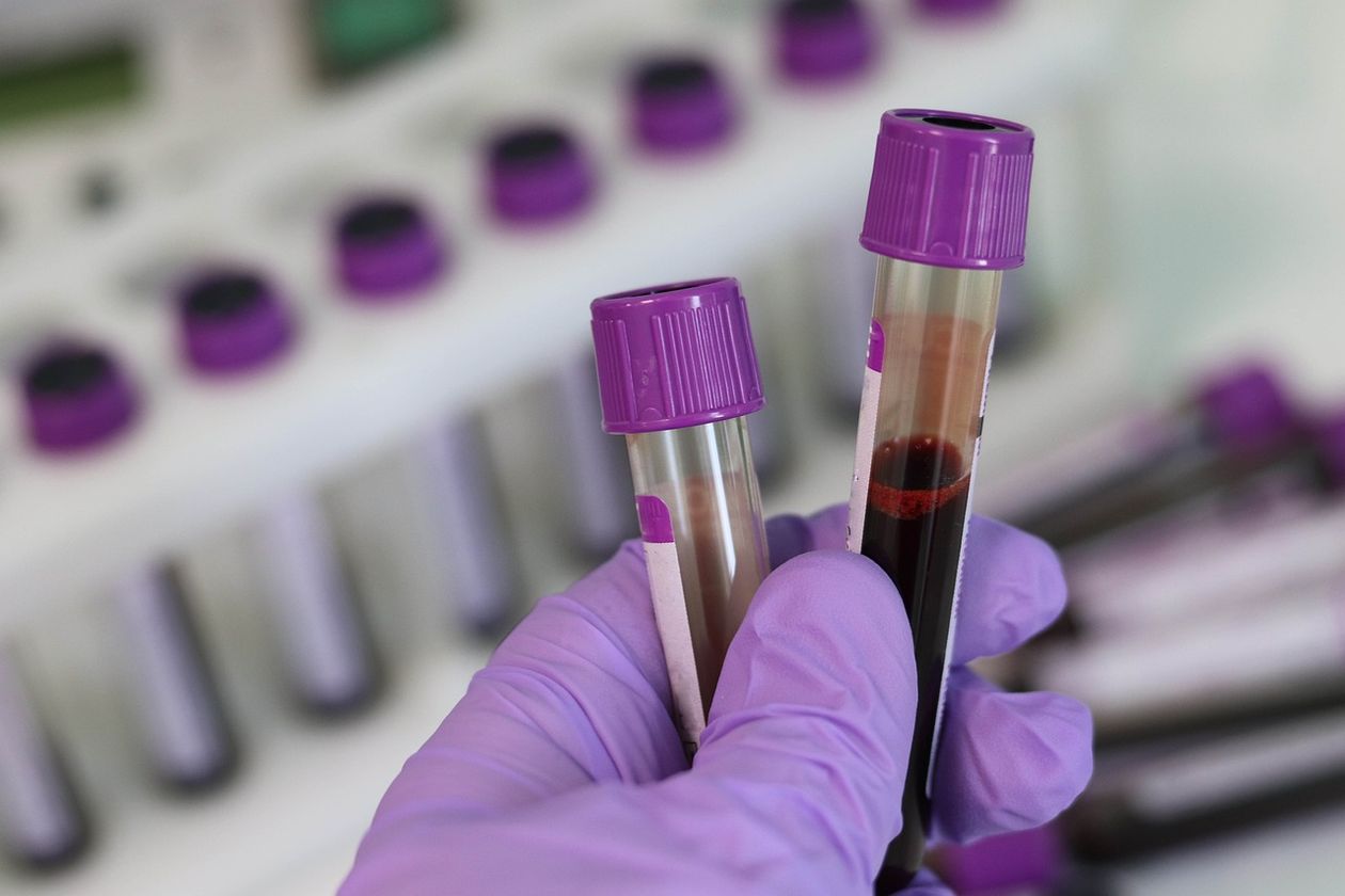 Polska: Dzień Diagnosty Laboratoryjnego